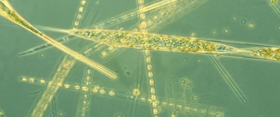 Auch Algen müssen mal .... , z.B. Phytoplankton, Diatomeen, Bacillariophyceae, Rhizosolenia spec (Bild: Annegret Stuhr, Geomar Helmholtz-Zentrum für Ozeanforschung Kiel) Phytoplankton, Diatomeen, Bacillariophyceae, Rhizosolenia spec