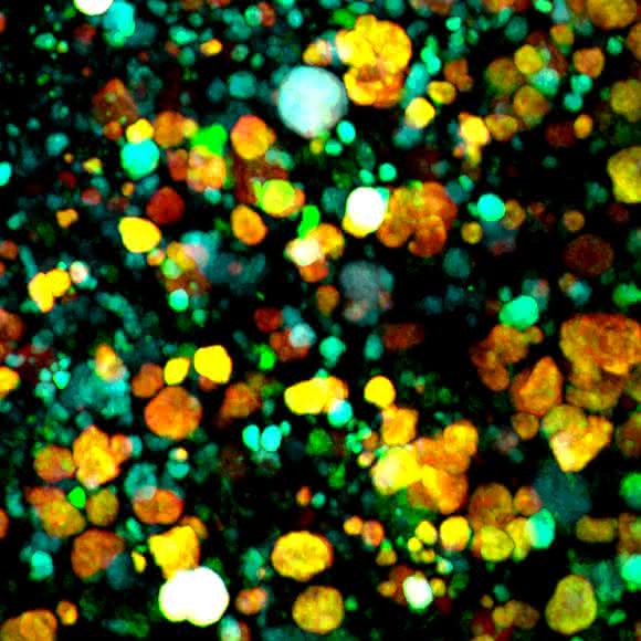 Mikrobielle Gemeinschaft Bioinformatik und Mikrobiom: Prüfverfahren für Analyse-Software entwickelt