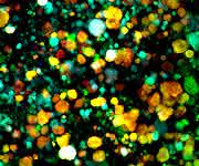 Mikrobielle Gemeinschaft Bioinformatik und Mikrobiom: Prüfverfahren für Analyse-Software entwickelt