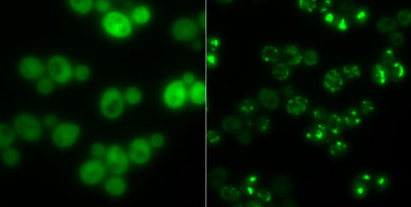 Elektronenmikroskopische Aufnahme von Hefezellen ohne und mit Proteinaggregaten