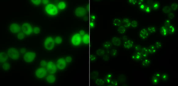 Hefezellen ohne Proteinaggregate (links) und solche mit (hell leuchtende Punkte): In Hungerzeiten dienen solche Klumpen als Zwischenlager für Proteine. (Bild: Gruppe Matthias Peter / ETH Zürich) Elektronenmikroskopische Aufnahme von Hefezellen ohne und mit Proteinaggregaten