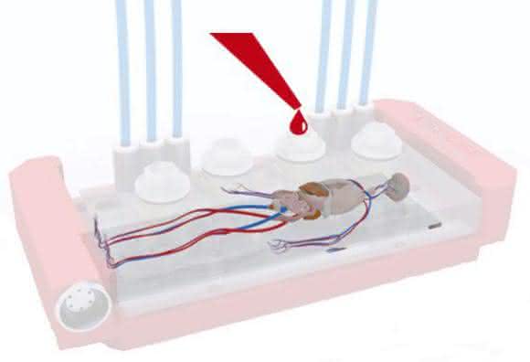 Von der Vision zum Paradigmenwechsel: Chancen und Herausforderungen mikrofluidischer Organ-on-a-Chip-Systeme in der Arzneimittelentwicklung