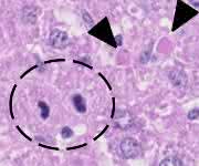 Ein Modell für chronische Lebererkrankung: Die Leberzellen der Maus sind genetisch so modifiziert, dass sie besonders häufig an Apoptose sterben. Apoptotische Zellen sind durch Pfeile gekennzeichnet, im Kreis sind teilende Zellen erkennbar. (Bild: Heikenwälder/DKFZ) Leberzellen der Maus, genetisch modifiziert