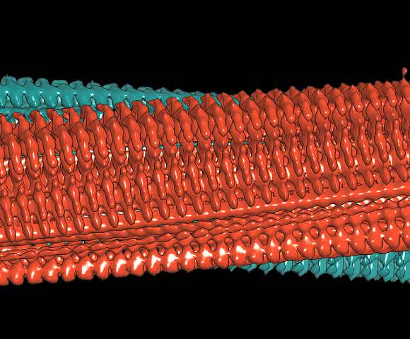 Alzheimer-Forschung: Bislang schärfstes Bild zeigt unbekannte Amyloid-Details