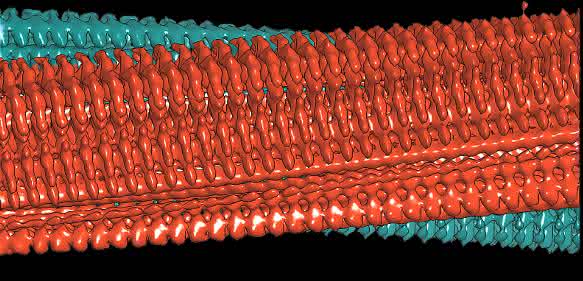Alzheimer-Forschung: Bislang schärfstes Bild zeigt unbekannte Amyloid-Details