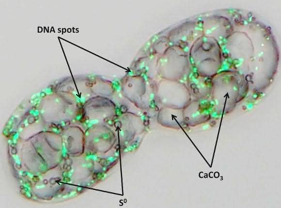 Achromatium oxaliferum mit großen Calciumkristallen, Schwefeltröpfchen und grün fluoreszierenden DNA-Spots