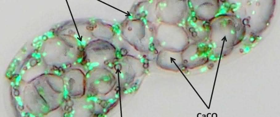 Achromatium oxaliferum mit großen Calciumkristallen, Schwefeltröpfchen und grün fluoreszierenden DNA-Spots