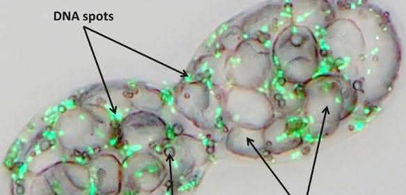 Achromatium oxaliferum mit großen Calciumkristallen, Schwefeltröpfchen und grün fluoreszierenden DNA-Spots