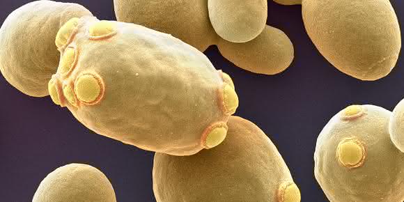 Die Bäckerhefe Saccharomyces cerevisiae (Bild: Universität Basel/SNI/Nano Imaging Lab) Die Bäckerhefe Saccharomyces cerevisiae (Bild: Universität Basel/SNI/Nano Imaging Lab)