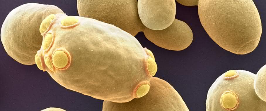 Die Bäckerhefe Saccharomyces cerevisiae (Bild: Universität Basel/SNI/Nano Imaging Lab) Die Bäckerhefe Saccharomyces cerevisiae (Bild: Universität Basel/SNI/Nano Imaging Lab)