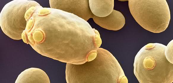 Die Bäckerhefe Saccharomyces cerevisiae (Bild: Universität Basel/SNI/Nano Imaging Lab)