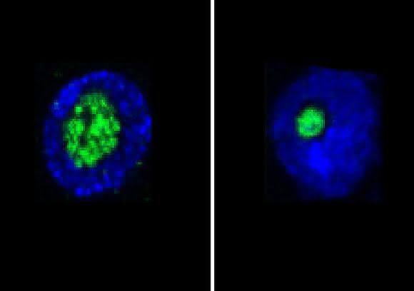Längerlebige Fruchfliegen (rechts) haben kleinere Nukleoli als ihre kürzer lebenden Verwandten (links). (Bild: MPI für Biologie des Alterns) Nukleoli