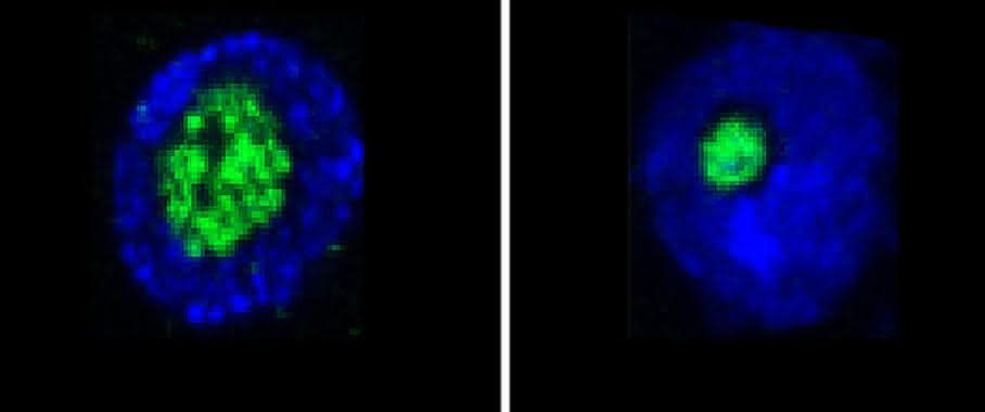 Längerlebige Fruchfliegen (rechts) haben kleinere Nukleoli als ihre kürzer lebenden Verwandten (links). (Bild: MPI für Biologie des Alterns) Nukleoli
