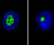 Längerlebige Fruchfliegen (rechts) haben kleinere Nukleoli als ihre kürzer lebenden Verwandten (links). (Bild: MPI für Biologie des Alterns) Nukleoli