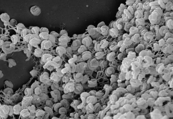 Elektronenmikroskopische Aufnahme eines Zell-Aggregats von Comammox-Bakterien der Art Nitrospira inopinata.