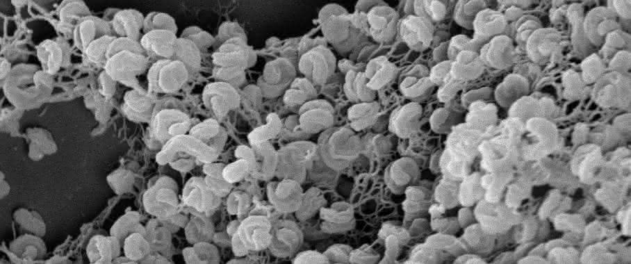 Elektronenmikroskopische Aufnahme eines Zell-Aggregats von Comammox-Bakterien der Art Nitrospira inopinata.