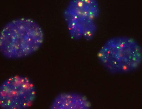 BRCA1 bei der Arbeit