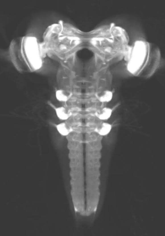 Lichtmikroskopische Aufnahme des Gehirns einer Fliegenlarve (Drosophila melanogaster)  (Bild: Universität Konstanz)