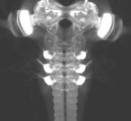Lichtmikroskopische Aufnahme des Gehirns einer Fliegenlarve Lichtmikroskopische Aufnahme des Gehirns einer Fliegenlarve (Drosophila melanogaster) (Bild: Universität Konstanz)