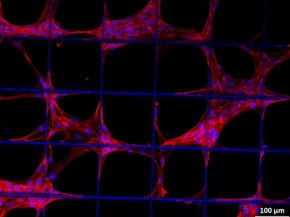 Vorläuferzellen des Stütz- und Bindegewebes (z.B. Knochen, Knorpel, Muskel, Bändern, Sehnen) auf einem Konstrukt aus biologisch abbaubarem Kunststoff (Quelle: Universitätsklinikum Würzburg) Vorläuferzellen des Stütz- und Bindegewebes auf einem Konstrukt aus biologisch abbaubarem Kunststoff