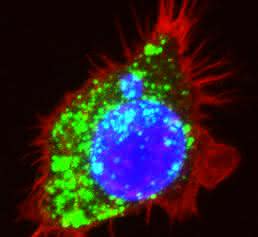 Makrophage Onkologie: Wie Krebszellen auf die Immunbremse drücken
