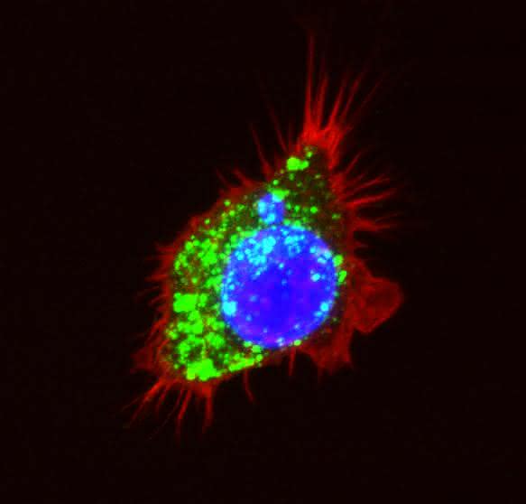 Makrophage Onkologie: Wie Krebszellen auf die Immunbremse drücken