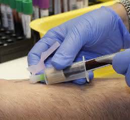 Bluttest Chemotherapie - ja oder nein?: Biomarker zeigen Aggressivität des Tumors an