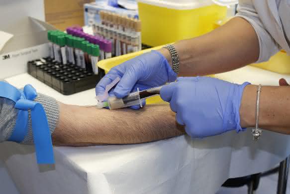Bluttest Chemotherapie - ja oder nein?: Biomarker zeigen Aggressivität des Tumors an