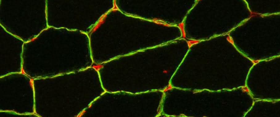 Querschnitt einer Muskelbiopsie
