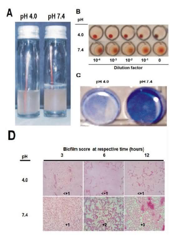 EAEC Under Stress: Loss of Biofilm Formation