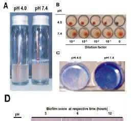 EAEC Under Stress: Loss of Biofilm Formation