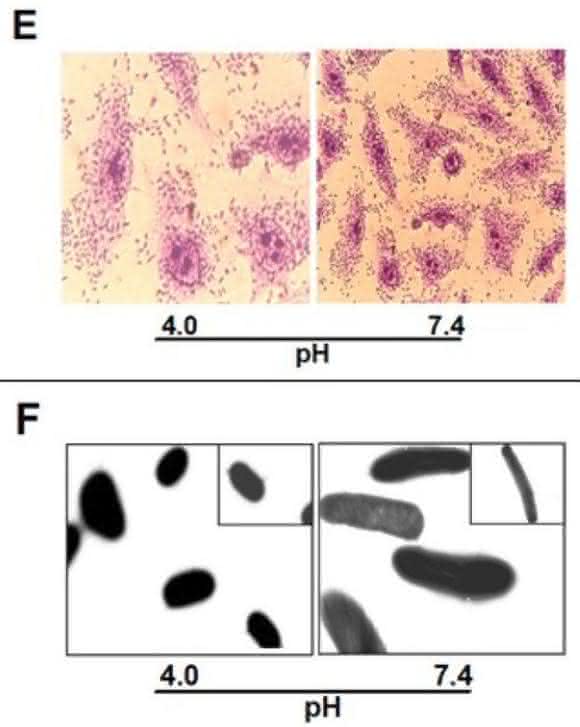 EAEC Under Stress: Loss of Biofilm Formation