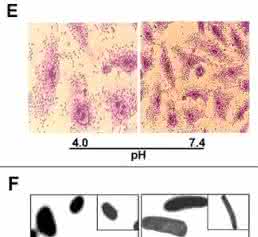EAEC Under Stress: Loss of Biofilm Formation