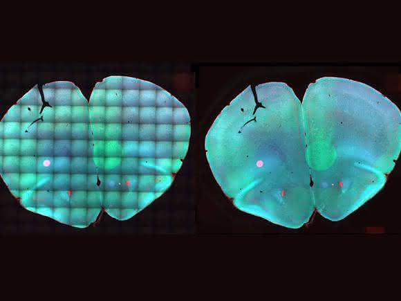 Bioimaging: Klare Sicht auf Stammzellentwicklung