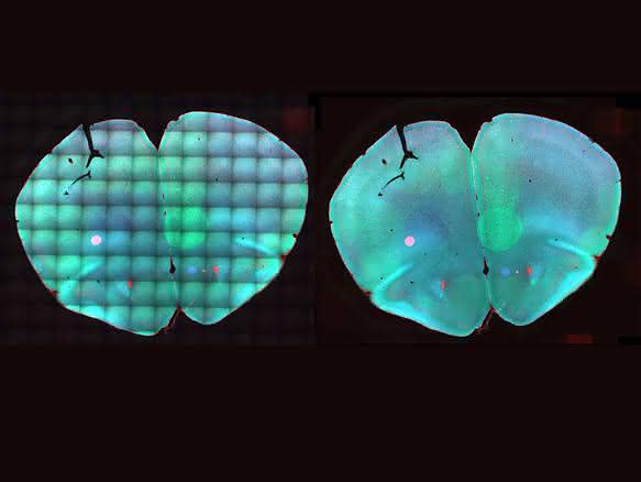 Bioimaging: Klare Sicht auf Stammzellentwicklung