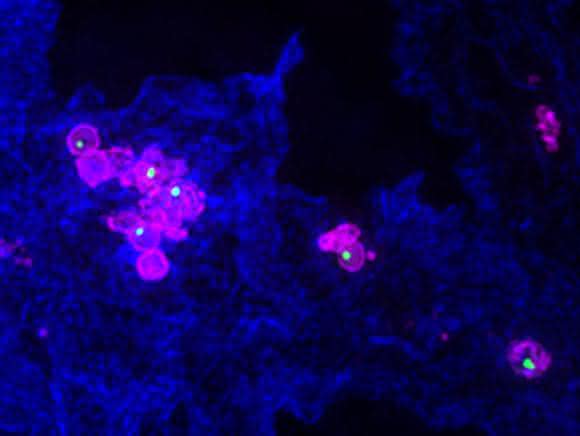 Mit Francisella novicida (pink) infizierte Makrophage und Nano-Harpune (grün) (Bild: Universität Basel, Biozentrum) Mit Francisella novicida (pink) infizierte Makrophage