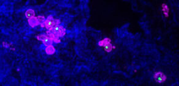 Mit Francisella novicida (pink) infizierte Makrophage