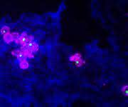 Mit Francisella novicida (pink) infizierte Makrophage und Nano-Harpune (grün) (Bild: Universität Basel, Biozentrum) Mit Francisella novicida (pink) infizierte Makrophage