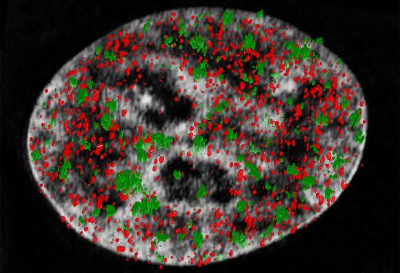 3D-Rekonstruktion von Nano-Foci (grün) mit dem Protein CTCF (rot) und DNA (grau). (Bild: Alexander Rapp)