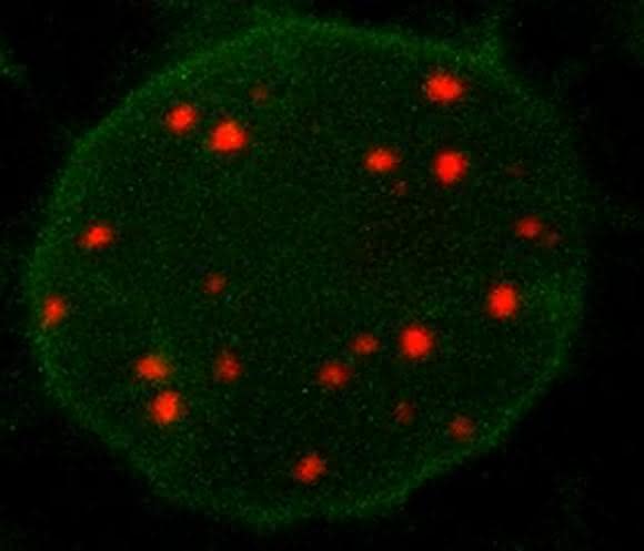Lebender Zellkern der Pflanze Nicotiana benthamiana mit rot fluoreszierender Telomer-DNA