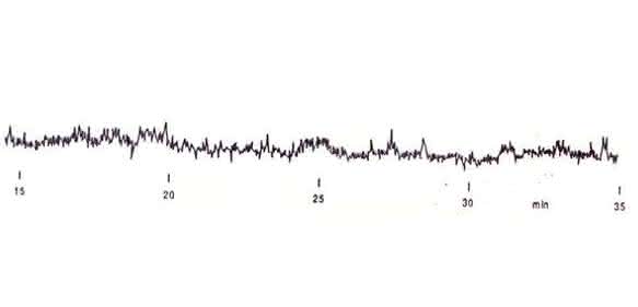 HPLC-Tipp: Zum Inneren eines UV-Detektors