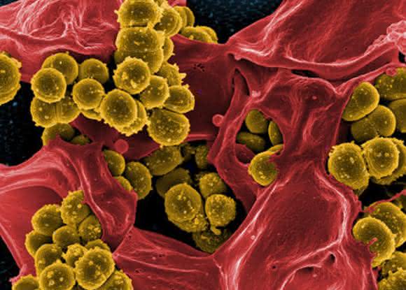 Methicillin-resistente Staphylococcus aureus Methicillin-resistente Staphylococcus aureus