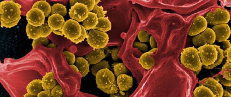 Methicillin-resistente Staphylococcus aureus Methicillin-resistente Staphylococcus aureus