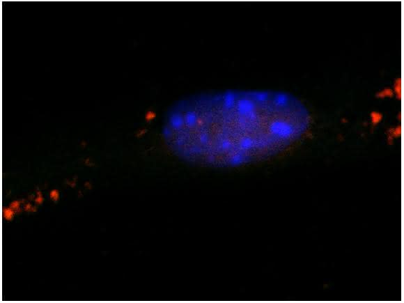 Gesunde Kontrollnervenzelle mit intakten „Müllsäcken“ (rot).  © AG van Echten-Deckert/Universität Bonn