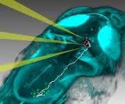 Mit neuen Methoden können Neurobiologen einzelne Nervenzellen im Zebrafischgehirn gezielt mit Licht aktivieren und beobachten, wie sich die Aktivität im Gehirn ausbreitet, um dann ein Verhalten auszulösen (Bild: MPI für Neurobiologie / dal Maschio)