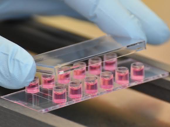 Das µ-Slide VI 0.5 Glass Bottom reduziert die Zahl der Einzelschritte und vereinfacht damit das Immunfluoreszenz-Protokoll. Das µ-Slide VI 0.5 Glass Bottom reduziert die Zahl der Einzelschritte und vereinfacht damit das Immunfluoreszenz-Protokoll.
