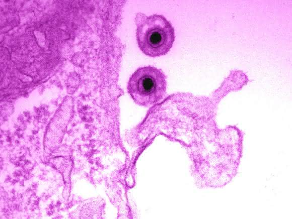 EHV-1 Virus. (Bild: Azab Walid)