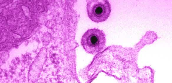 EHV-1 Virus. (Bild: Azab Walid) EHV-1 Virus. (Bild: Azab Walid)