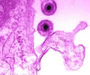 EHV-1 Virus. (Bild: Azab Walid)