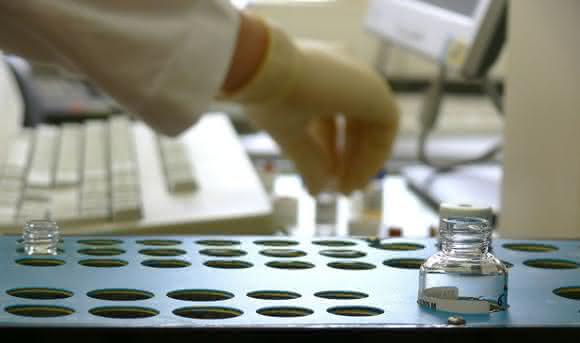 Manuelle Probenvorbereitung